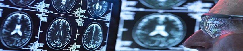 神經干細胞移植的過程