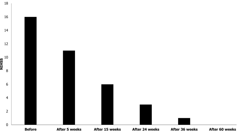 圖3：患者的美國國立衛(wèi)生研究院卒中量表評分。在第一次治療后的60周內(nèi)，患者的美國國立衛(wèi)生研究院卒中量表評分逐漸下降。