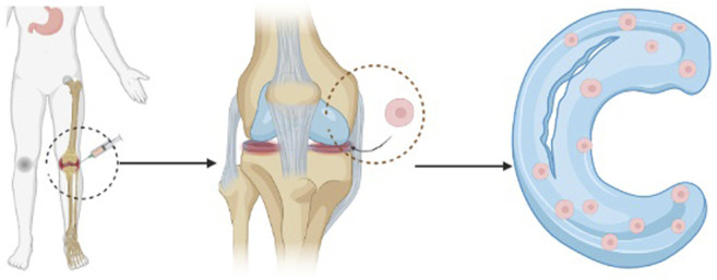 圖1：干細胞注射方法的過程示意圖。