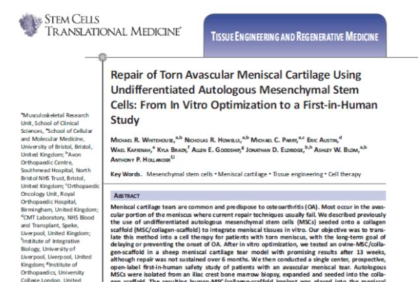 間充質(zhì)干細胞能夠幫助修復受損的半月板組織，不用手術(shù)切除受傷部位也能讓膝關(guān)節(jié)功能恢復正常。