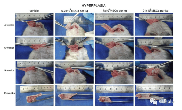 全身注射同種異體間充質(zhì)干細(xì)胞不會(huì)加速癌前病變的進(jìn)展