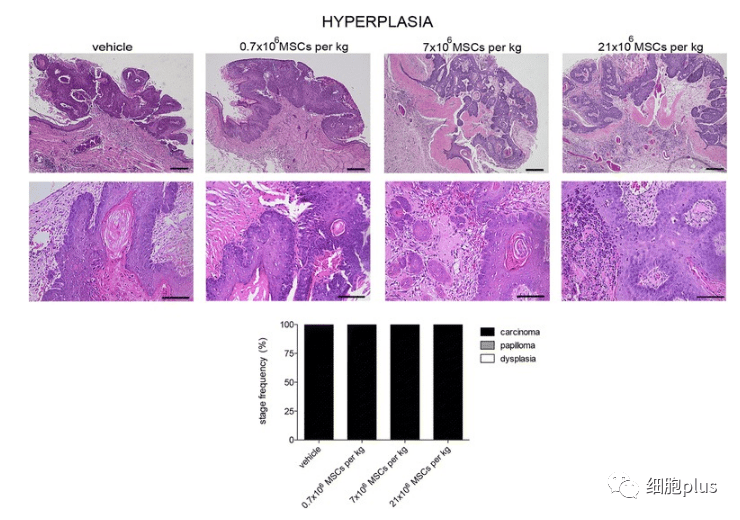 2?全身施用同種異體間充質(zhì)干細(xì)胞不會(huì)增加腫瘤惡性程度