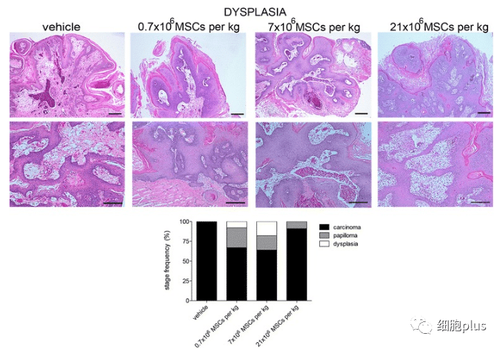 在增生期，全身注射同種異體間充質(zhì)干細(xì)胞不會(huì)增加腫瘤的惡性程度。