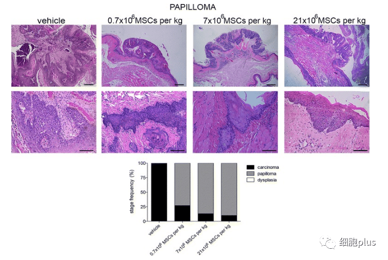 在非典型增生期，全身注射同種異體間充質(zhì)干細(xì)胞不會(huì)增加腫瘤的惡性程度。