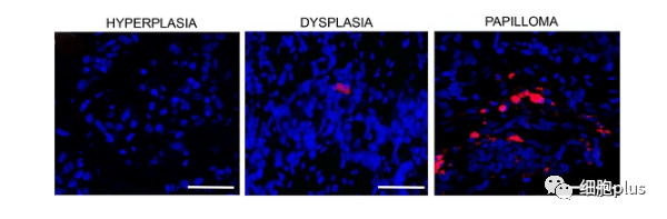 4?全身注射同種異體間充質(zhì)干細(xì)胞很少進(jìn)入癌前病變