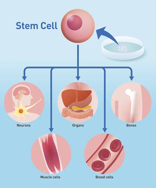 自體干細胞移植：工作原理、益處和風險