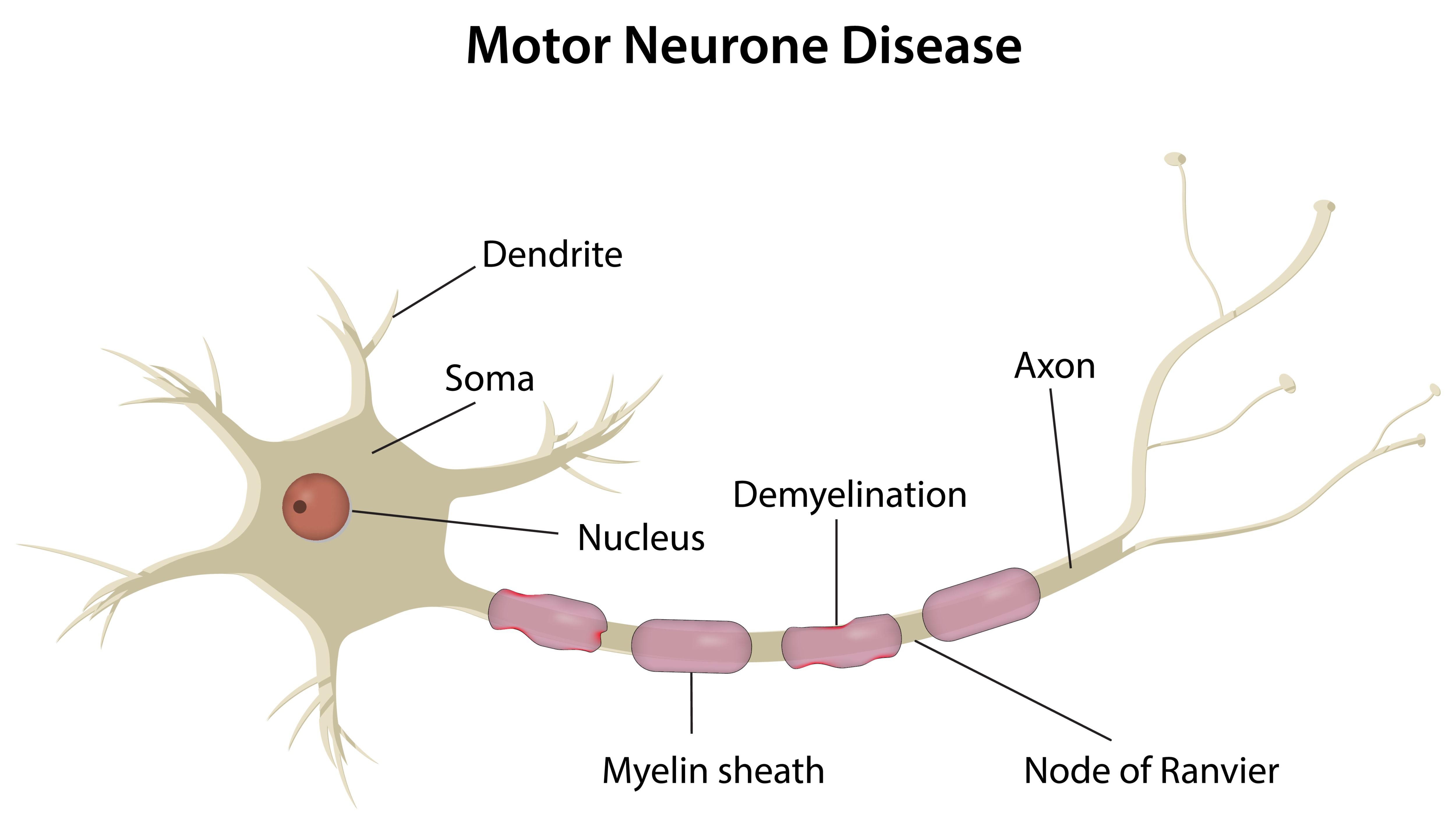 什么是運動神經元??？