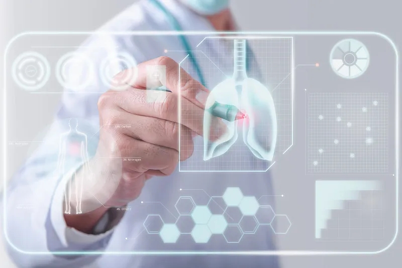 慢性阻塞性肺疾病的干細胞療法:臨床前研究和臨床試驗的現狀 慢性阻塞性肺疾病的干細胞療法:臨床前研究和臨床試驗的現狀