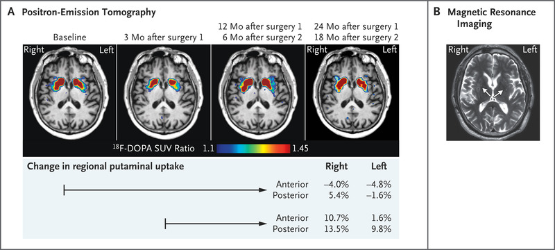 成像結果 成像結果