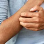 肝臟損傷的警告信號,肝臟疾病的警告信號 - 瘙癢 肝臟損傷的警告信號,肝臟疾病的警告信號 - 瘙癢