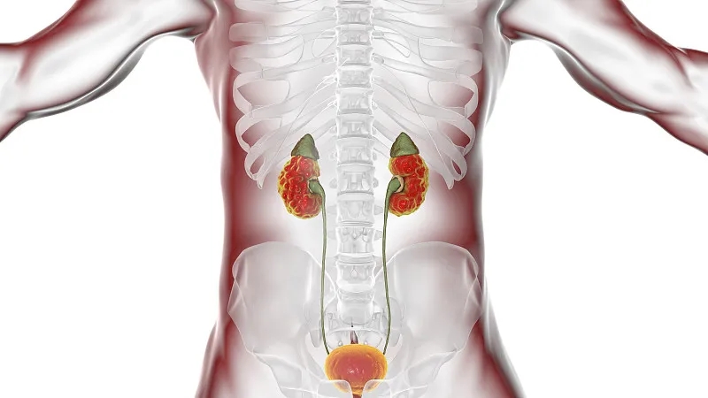 間充質干細胞治療狼瘡性腎炎的臨床研究進展