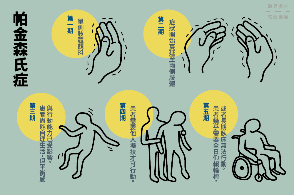 神經(jīng)干細(xì)胞移植管理帕金森病：挑戰(zhàn)、納米技術(shù)支持和前景