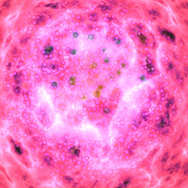 干細(xì)胞簡介| 帕金森病的干細(xì)胞治療