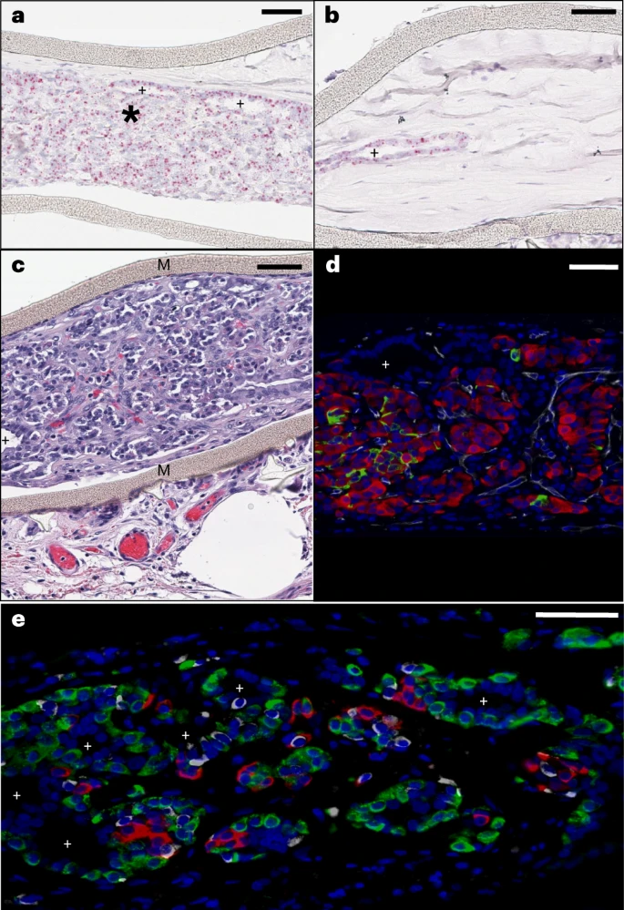 圖3:植入后第6個月時裝置封裝的人類干細胞衍生植入物的成分。 圖3:植入后第6個月時裝置封裝的人類干細胞衍生植入物的成分。