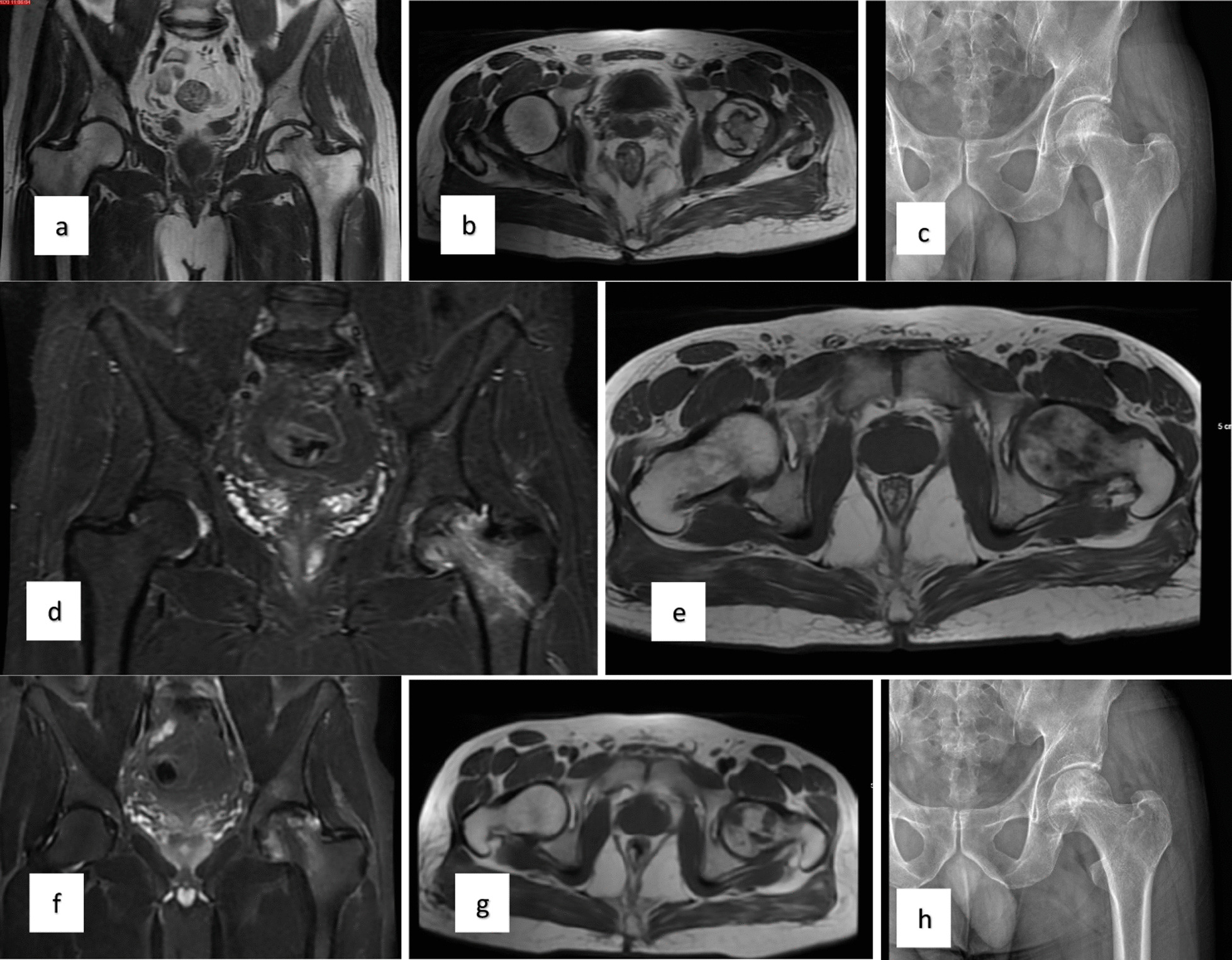 對患者的術前、3個月、6個月、1年和2年隨訪進行評估（圖1）。