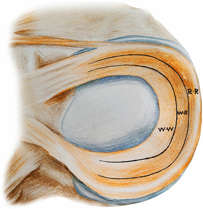 圖1:根據(jù)報(bào)告的血管分布,半月板的插圖展示了經(jīng)典的三個(gè)區(qū)域 圖1:根據(jù)報(bào)告的血管分布,半月板的插圖展示了經(jīng)典的三個(gè)區(qū)域