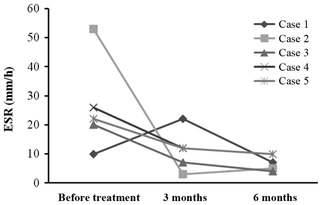 圖3:每位患者在治療前后的ESR。3例患者血沉明顯下降