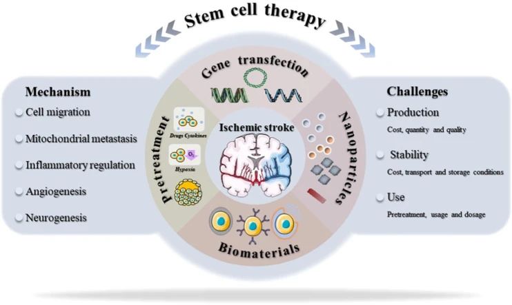 干細胞治療中風新進展:一項206人的隨機臨床試驗結果揭曉啦! 干細胞治療中風新進展:一項206人的隨機臨床試驗結果揭曉啦!