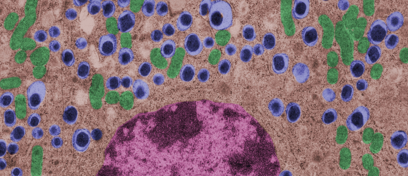 利用間充質干細胞治療1型糖尿病的潛力如何？