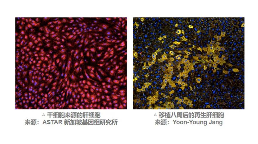 MSC有望通過不同途徑調(diào)動肝臟細(xì)胞再生來改善預(yù)后。