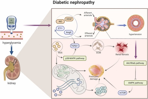 圖1:糖尿病腎病的病理信號(hào)。 圖1:糖尿病腎病的病理信號(hào)。