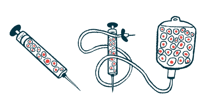 免疫調(diào)節(jié)性Tregs增強(qiáng)干細(xì)胞治療帕金森病的研究 免疫調(diào)節(jié)性Tregs增強(qiáng)干細(xì)胞治療帕金森病的研究