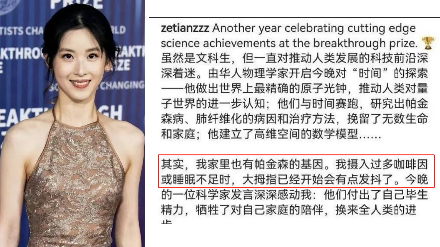 章澤天自曝有帕金森病家族史，干細胞療法讓年輕人不再懼“帕”