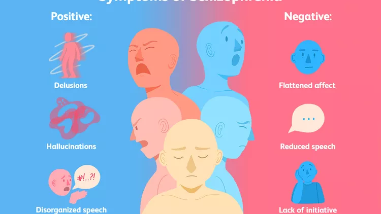 精神分裂癥的類型有哪些？