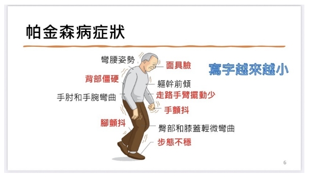 帕金森病癥狀 帕金森病癥狀