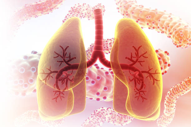 獲得國家藥監(jiān)局批準！廣州醫(yī)科大學附屬第一醫(yī)院正在開展人臍帶源間充質(zhì)干細胞注射液治療IPF臨床研究