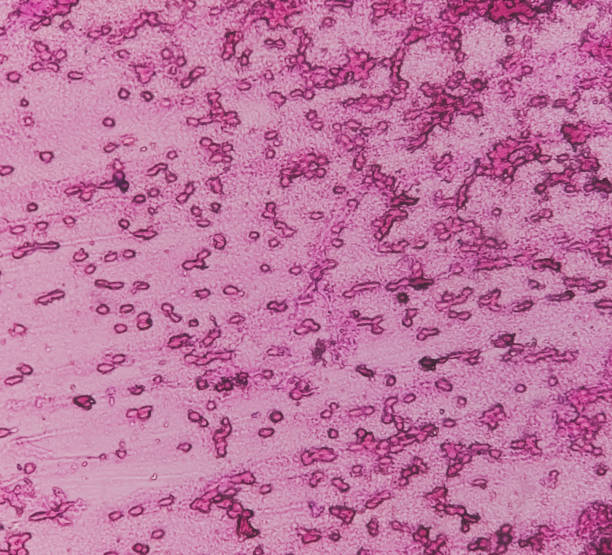 人羊膜上皮細胞對中樞神經系統損傷和疾病的治療潛力
