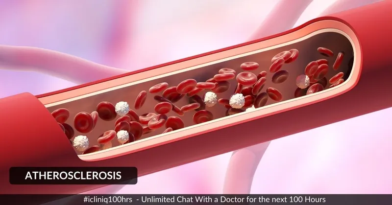 動脈粥樣硬化的體征和癥狀是什么？治療方案有哪些？