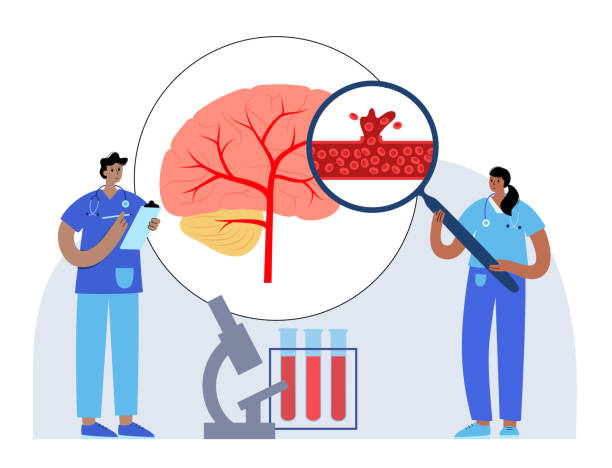 圍產(chǎn)期中風(fēng)-類型、原因和風(fēng)險(xiǎn)因素