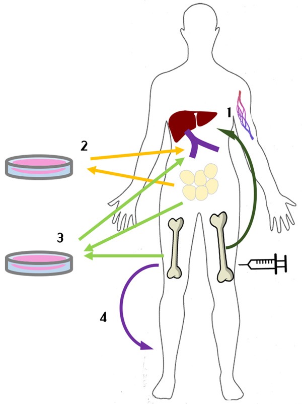 圖1：間充質干細胞治療1型糖尿病方法示意圖。