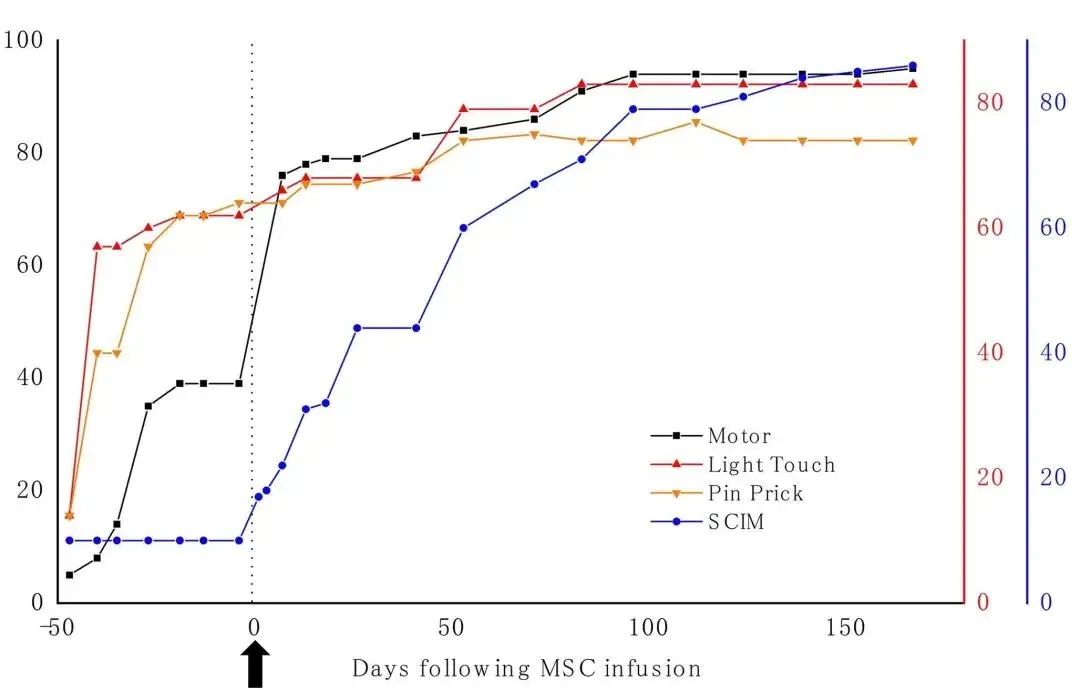 干細(xì)胞治療脊髓損傷的治療效果如何? 干細(xì)胞治療脊髓損傷的治療效果如何?