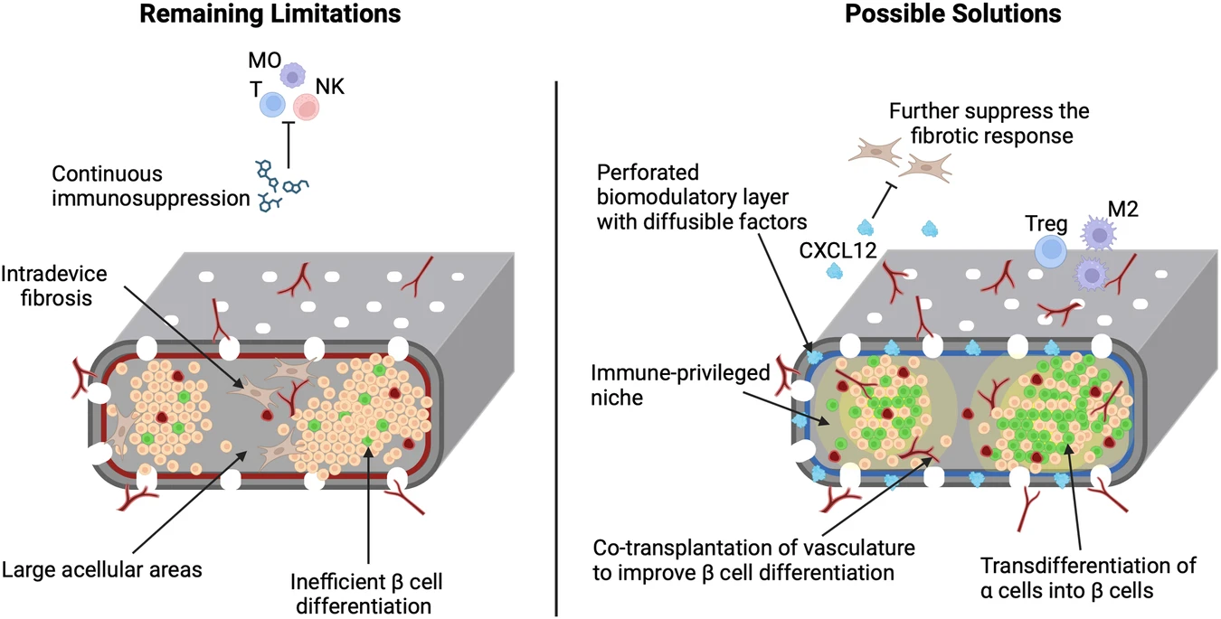圖2：增加功能性β細胞質(zhì)量和消除全身免疫抑制的策略