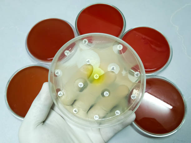 骨髓移植成功率100%嗎? 骨髓移植成功率100%嗎?