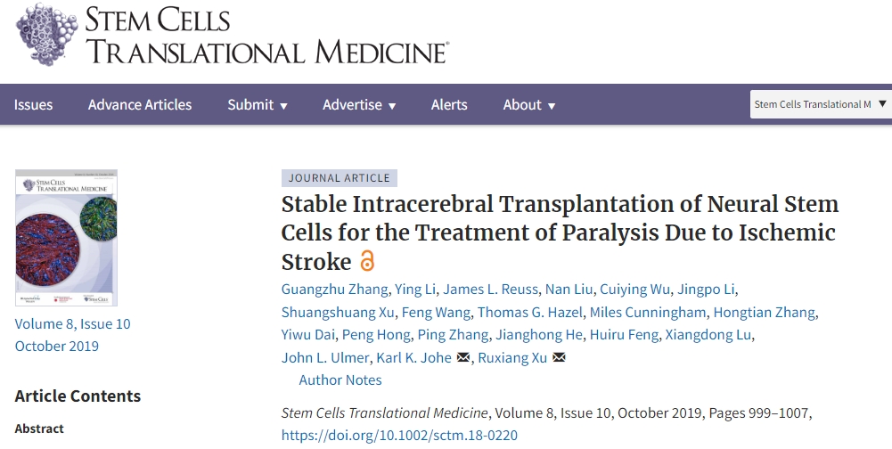 解放軍總醫院：神經干細胞移植治療缺血性中風，臨床表明效果良好！
