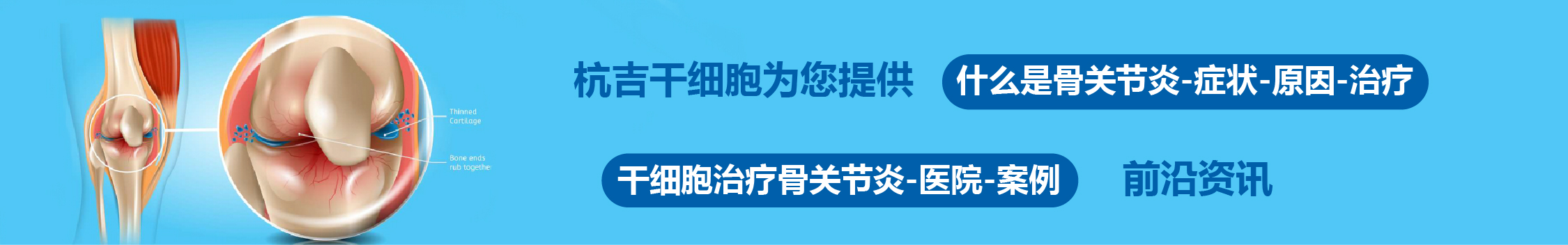 國內外干細胞醫院治療骨關節炎的臨床案例