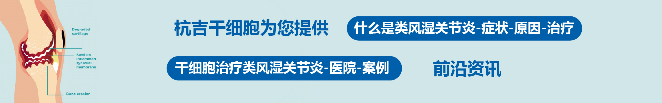 國內外干細胞醫院治療類風濕關節炎的臨床案例