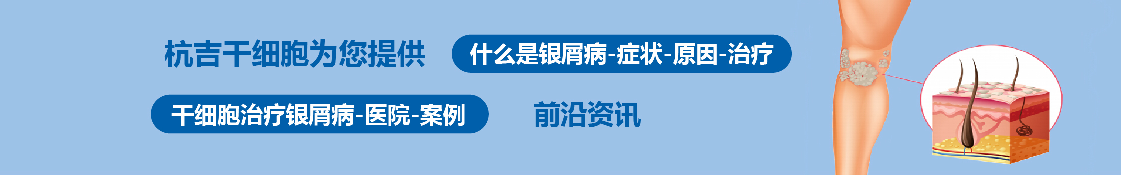 國內外干細胞醫(yī)院治療銀屑病的臨床案例