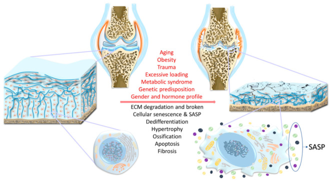 圖1：骨關節炎（OA）的風險因素、結構改變和軟骨細胞特異性變化。