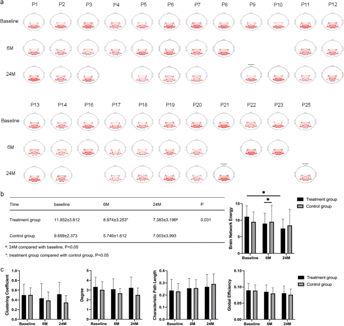 腦網絡能量變化