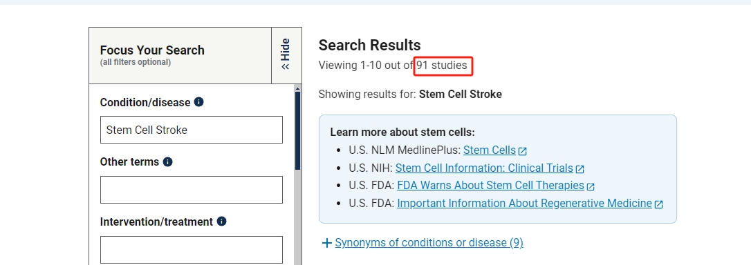 干細胞治療中風(fēng)的臨床研究進展