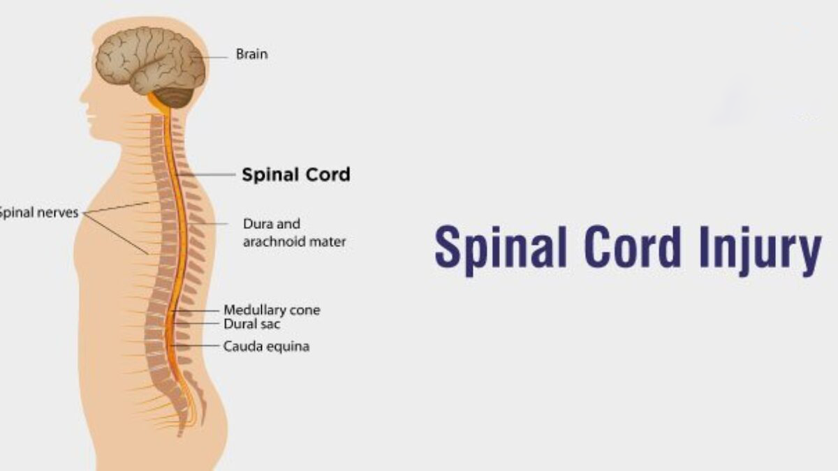 3項(xiàng)研究75例患者，評(píng)估干細(xì)胞治療脊髓損傷的安全性和有效性