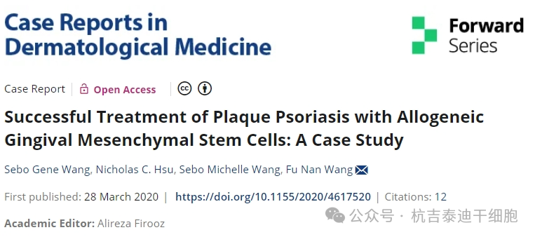 同種異體牙齦間充質干細胞成功治療斑塊性銀屑病：案例研究