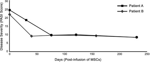 圖 1?. 移植 MSCs 前后兩例患者的銀屑病面積和嚴(yán)重程度指數(shù) (PASI) 評(píng)分總結(jié)。在輸注 MSCs 后的隨訪中,每例患者的 PASI 評(píng)分均有所下降。評(píng)分由第三方皮膚科醫(yī)生進(jìn)行。臨床改善持久,患者 A 的改善持續(xù)超過(guò) 150 天,患者 B 的改善持續(xù)超過(guò) 200 天。 圖 1?. 移植 MSCs 前后兩例患者的銀屑病面積和嚴(yán)重程度指數(shù) (PASI) 評(píng)分總結(jié)。在輸注 MSCs 后的隨訪中,每例患者的 PASI 評(píng)分均有所下降。評(píng)分由第三方皮膚科醫(yī)生進(jìn)行。臨床改善持久,患者 A 的改善持續(xù)超過(guò) 150 天,患者 B 的改善持續(xù)超過(guò) 200 天。