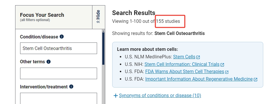 干細(xì)胞治療骨關(guān)節(jié)炎的臨床研究進(jìn)展 干細(xì)胞治療骨關(guān)節(jié)炎的臨床研究進(jìn)展