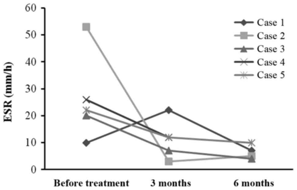 每位患者治療前后的 CRP 水平。1 名患者的 CRP 水平降低，而其他 4 名患者的 CRP 水平保持穩(wěn)定并在正常范圍內(nèi)。CRP，C 反應(yīng)蛋白。
