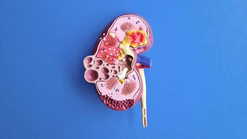 薈萃分析|12項(xiàng)研究表明干細(xì)胞治療可以改善狼瘡性腎炎患者的腎功能損傷